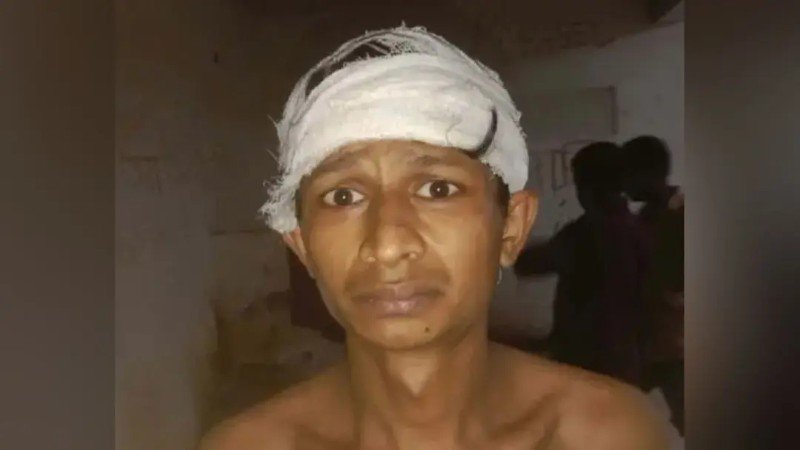 কথিত মাদকবিরোধী অভিযানে মাথা ফাটলো যুবকের, দায় নিচ্ছে না কেউ