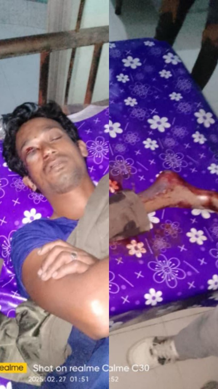 নাটোরে মাদকে বাধা দেওয়ায় যুবকের চোখ উৎপাটন ও পায়ের রগ কর্তন, আটক ১